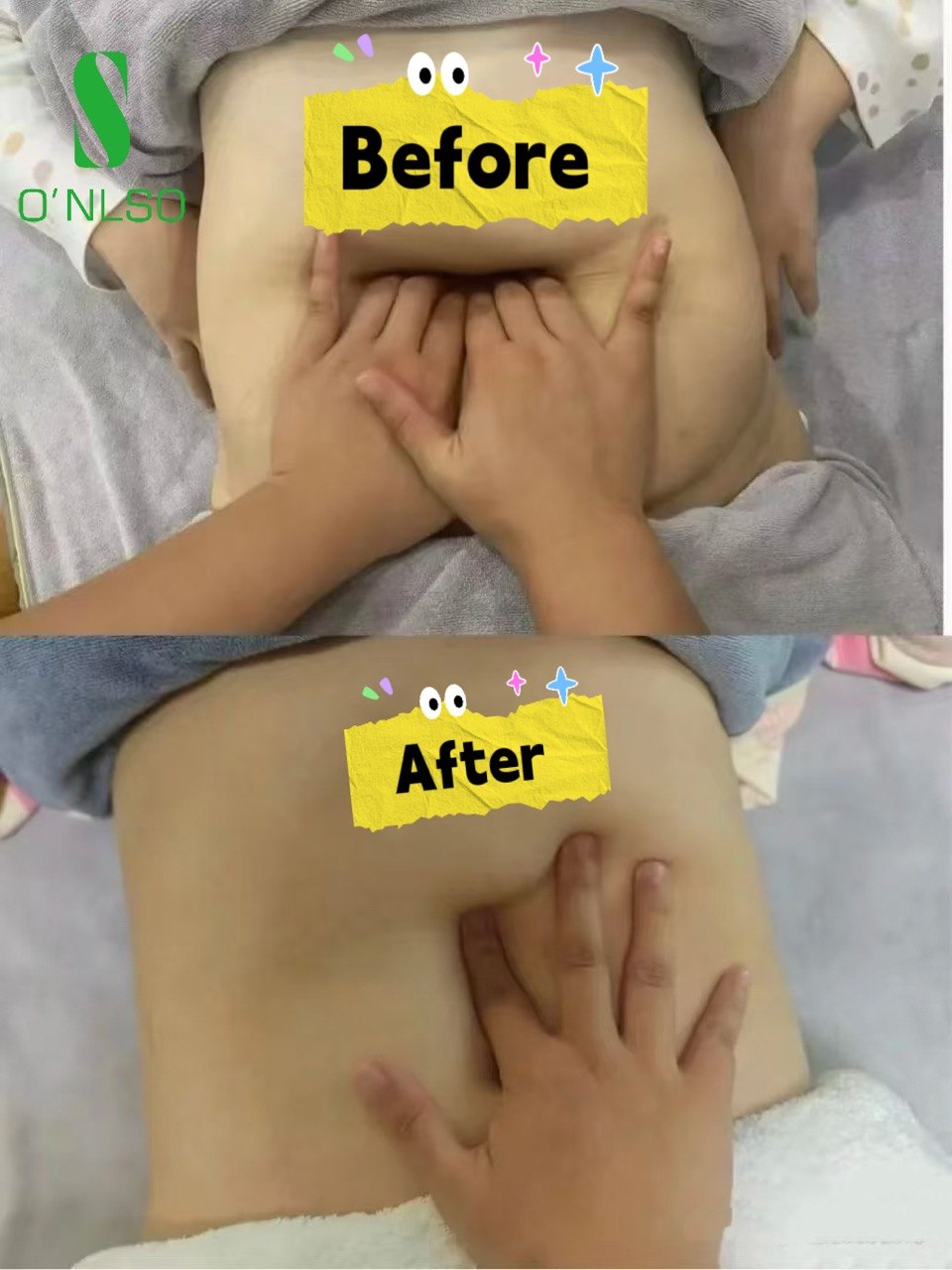 ONLSO postpartum abdominal check comparison